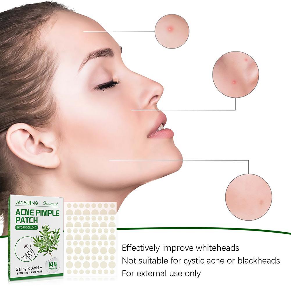 144pcs Acne Pimple Patches Tra - Herbal Wellness Tea recension och pris